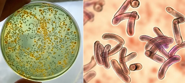 Vibrio Risk